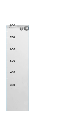Turbidity